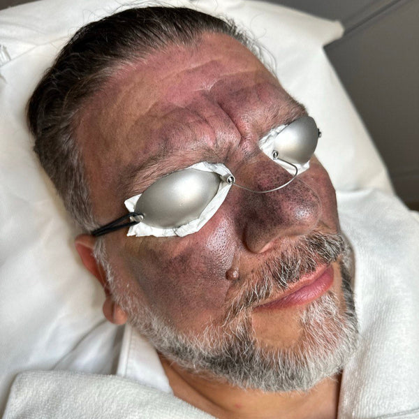 Person lying down with silver eye masks on their face
