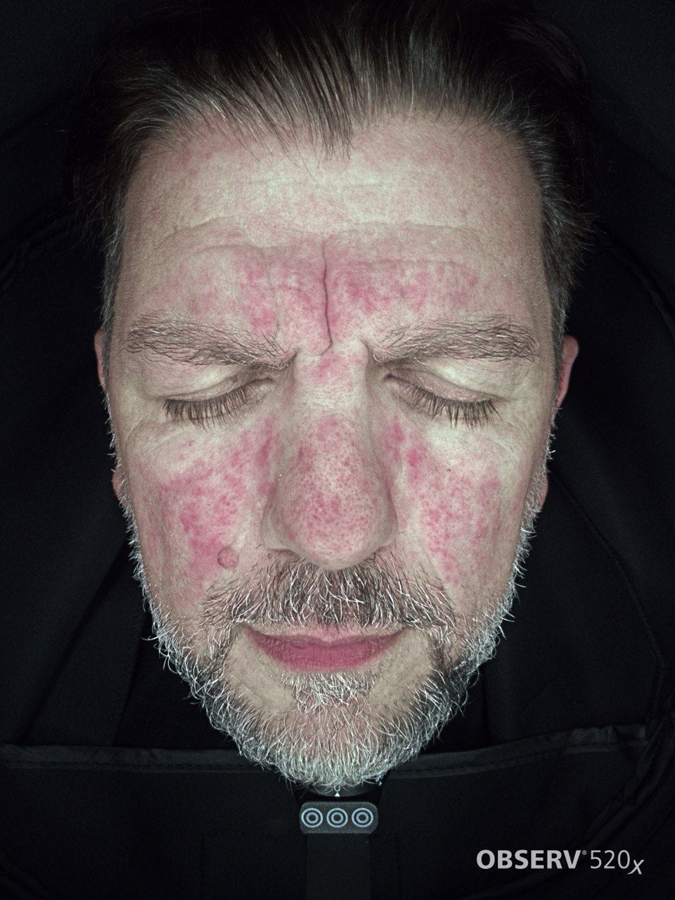Men's Skin Analysis & Treatment