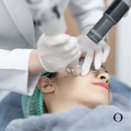 Acne Scar Clear Laser