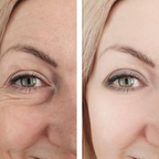 Advanced Eye Lift & Firm