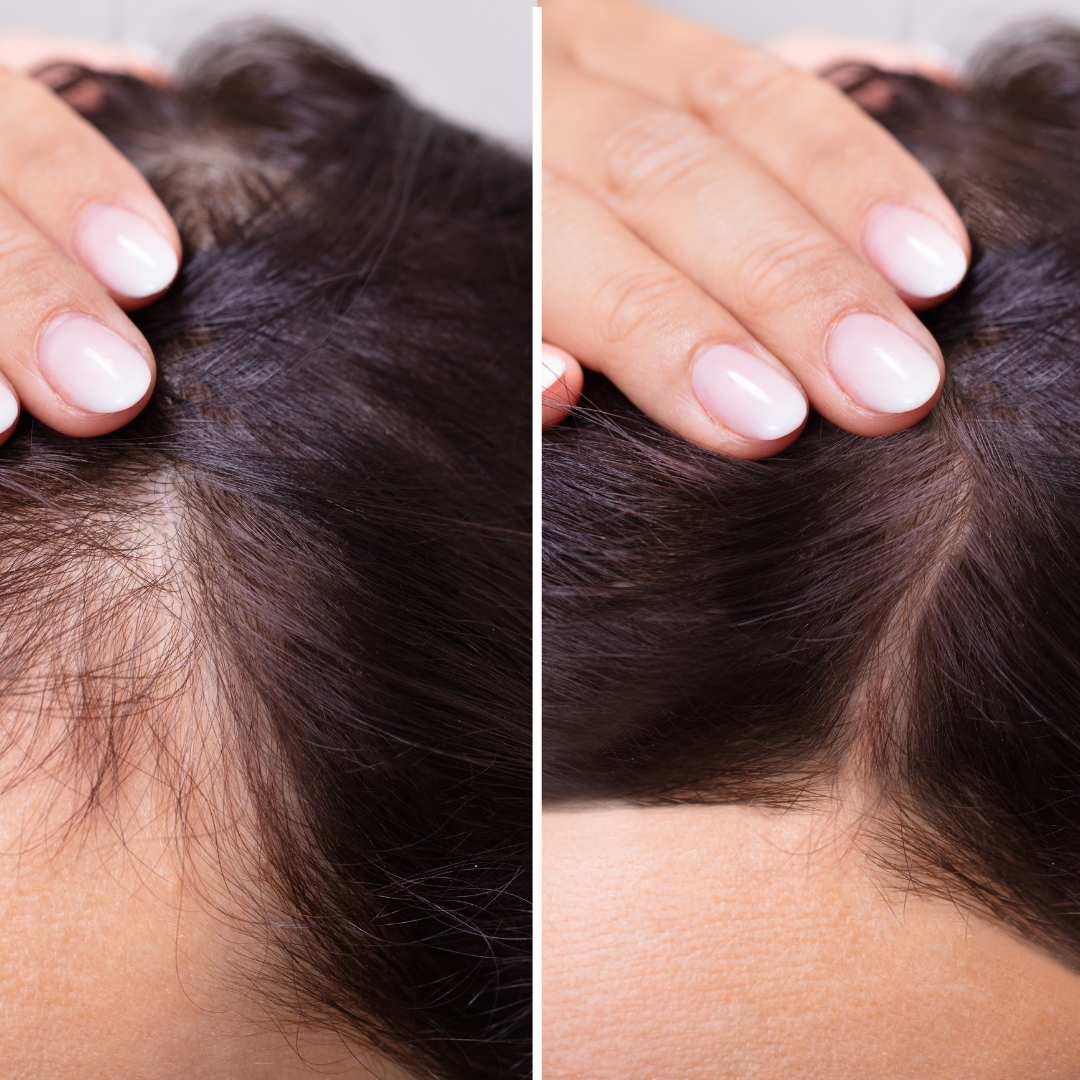 Close-up of a hand touching hair with a focus on texture and density.