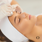 Astrodome Acne Oxygen Facial