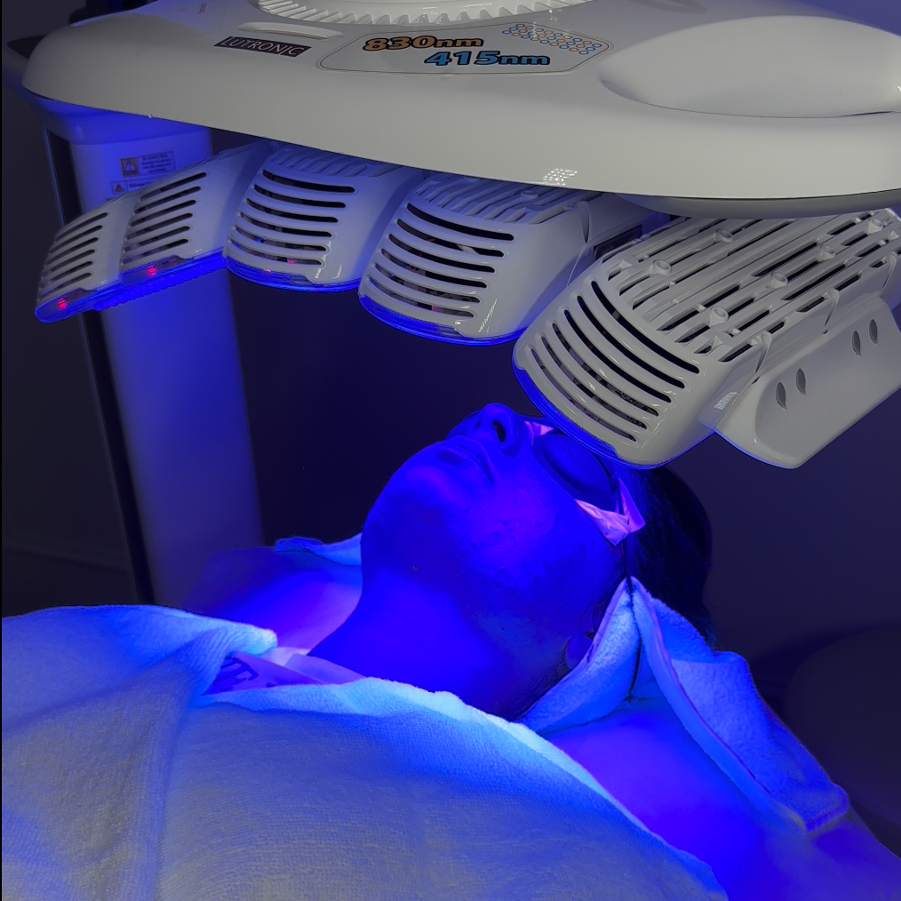 Microbiome Needling + Blue LED light