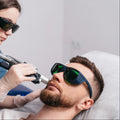 Men's Laser Pigment Removal