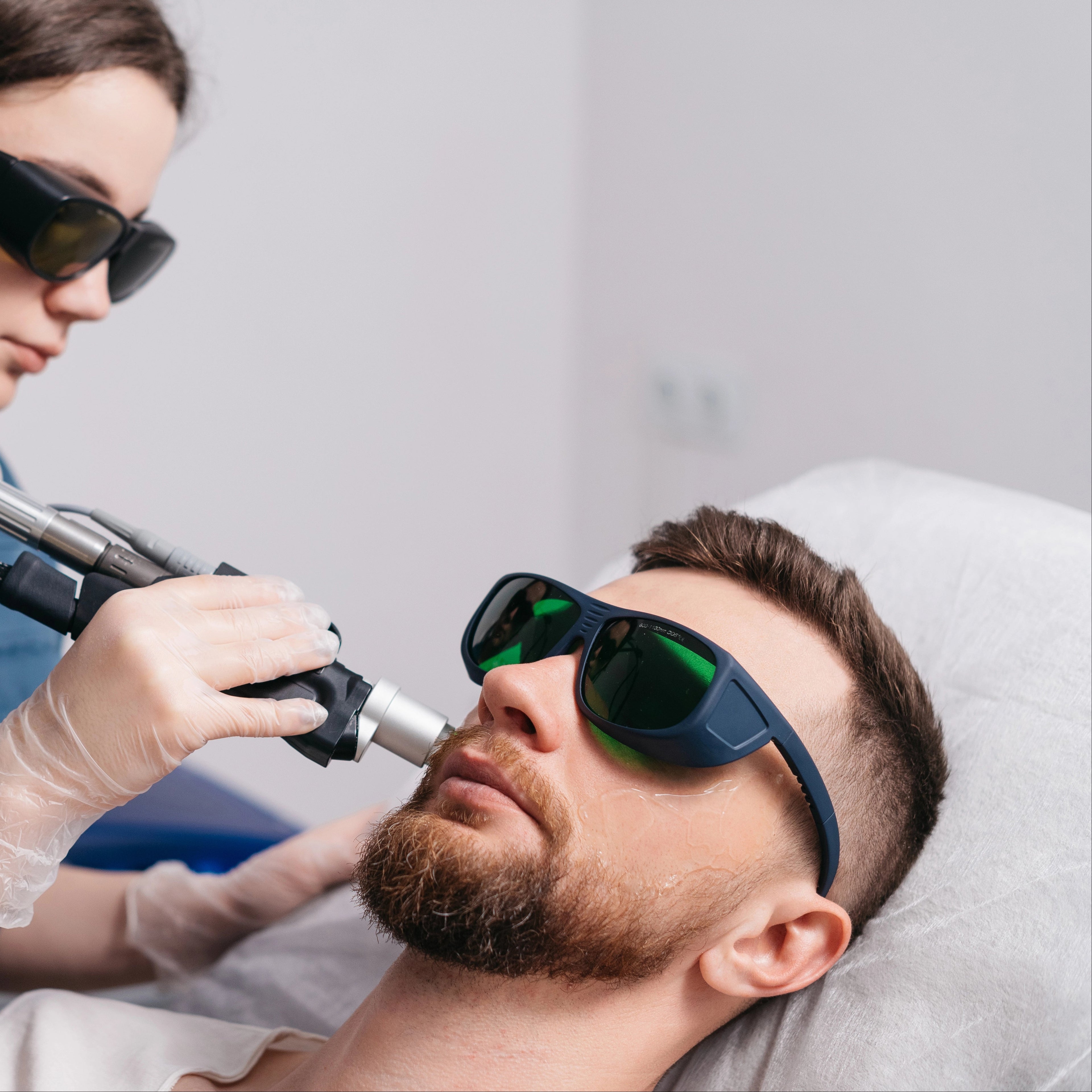 Men's Laser Pigment Removal
