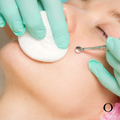 Extractions Add-On