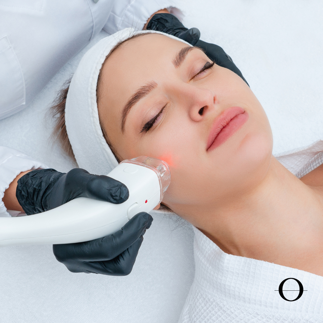 Facial Laser Hair Bleaching