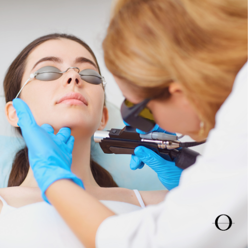 Gold Acne Laser Treatment