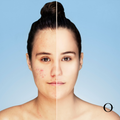 Herbal Peel