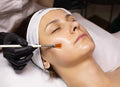 Dermal Chemical Peels