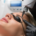 Tattoo Removal Consultation