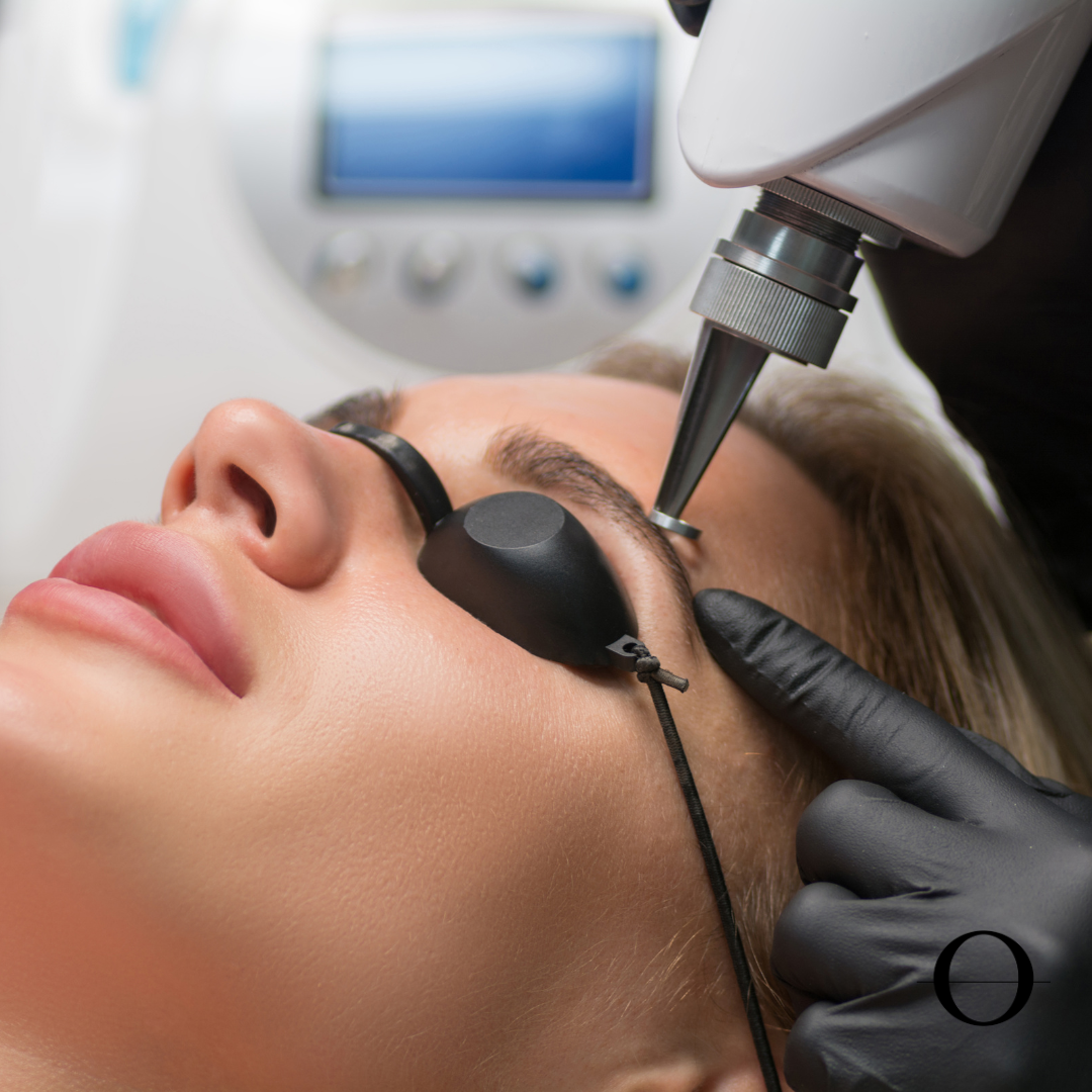 Tattoo Removal Consultation