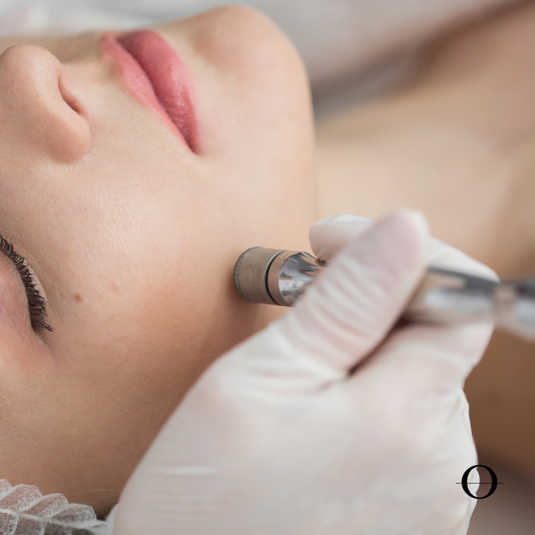 Microdermabrasion Facial
