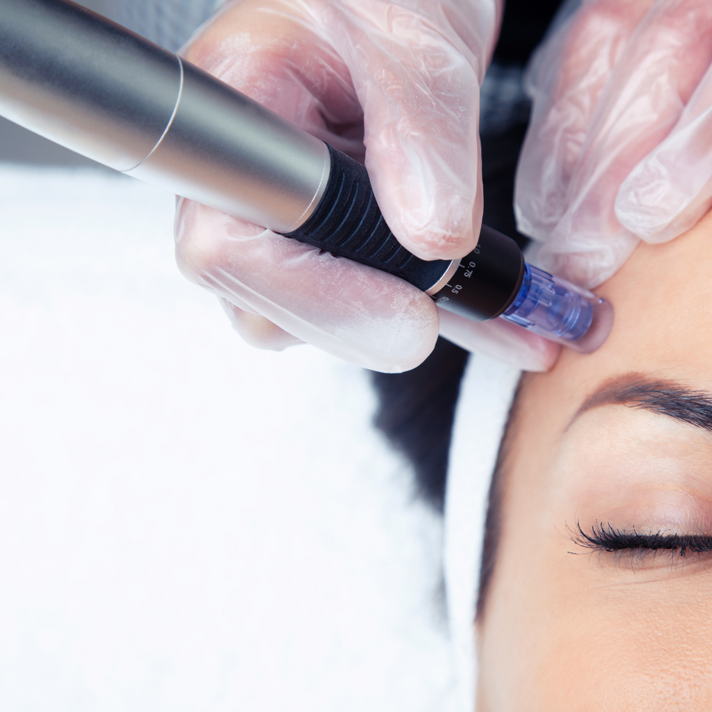 Nano Microneedling