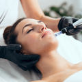 Exosome Micro-Needling