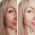 Oxygen Rehydrating Facial