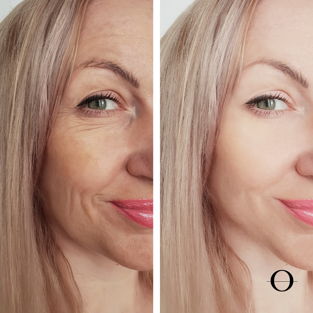 Oxygen Rehydrating Facial