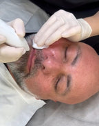 Person receiving a facial treatment with gloves on hands
