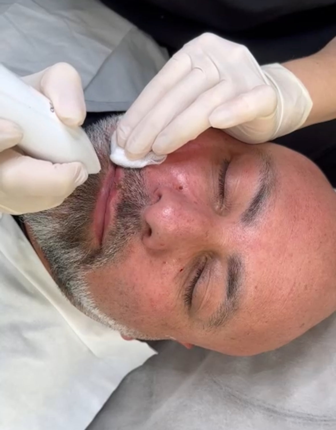 Person receiving a facial treatment with gloves on hands