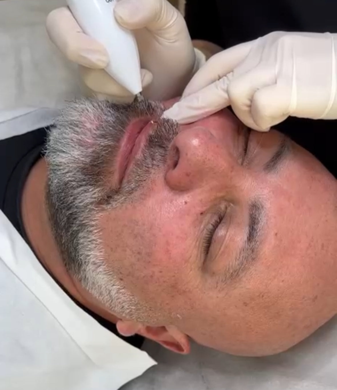 Person receiving a facial treatment with a device on a white background