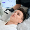 RF Skin Needling Face TriFractional