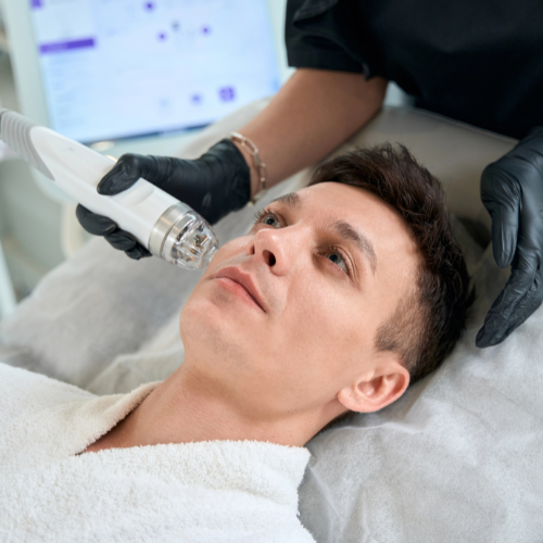 RF Skin Needling Face TriFractional