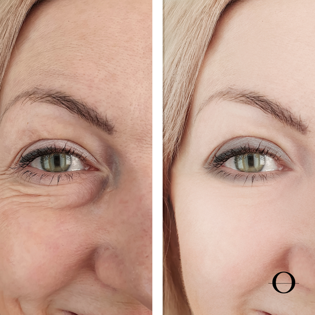 Revitalising Eye Infusion