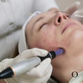 StemCell Radiance